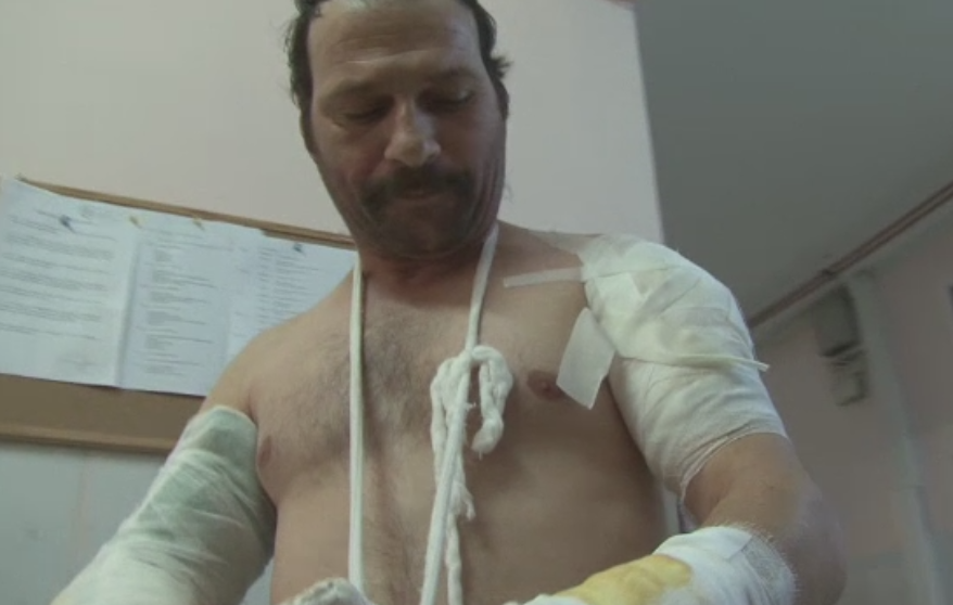 "Ne-am luptat, cand eu peste el, cand el peste mine". Marturia unui bacauan atacat de urs in timp ce taia lemne in padure