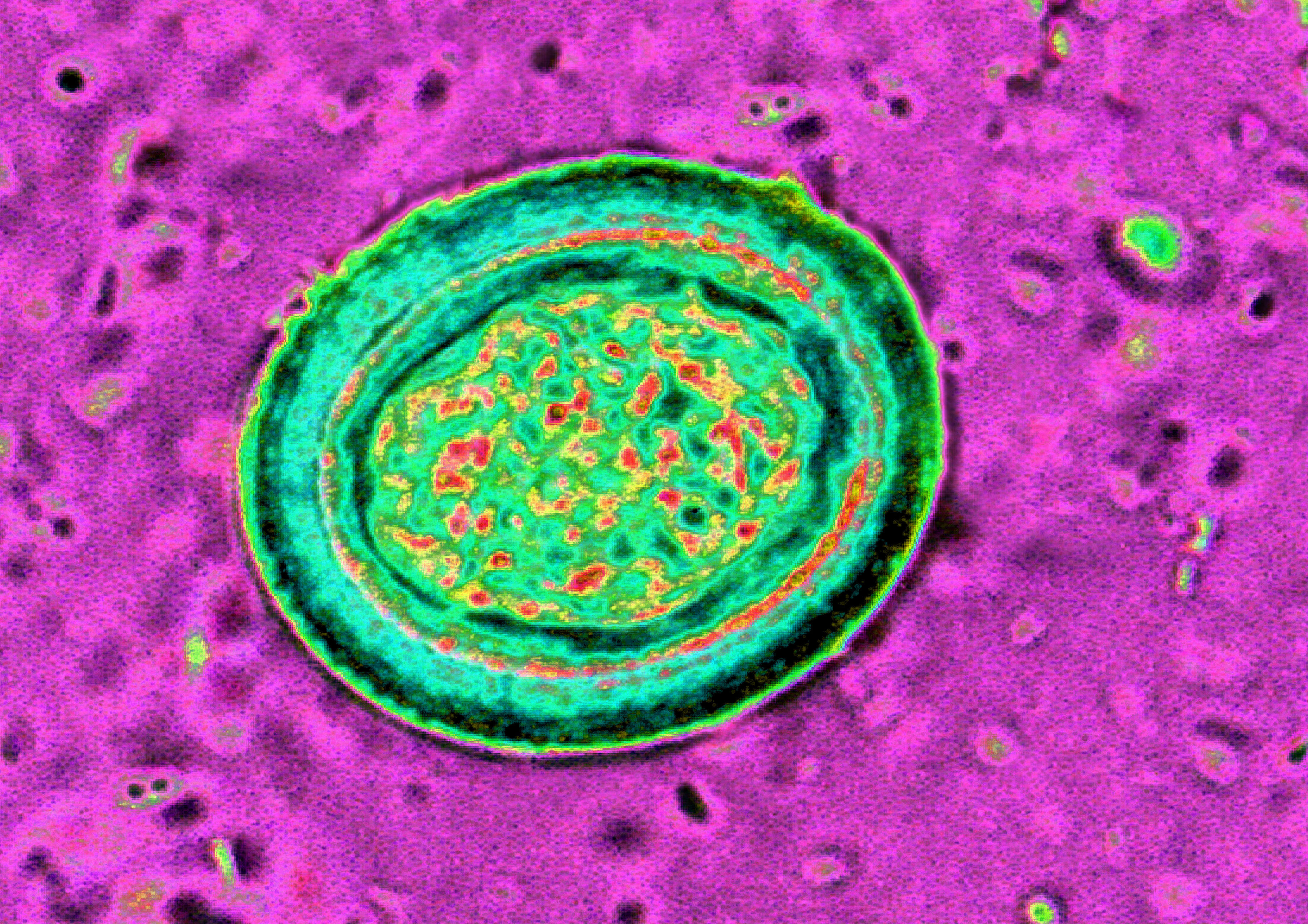 Timp de doi ani, a avut dureri groaznice in zona stomacului. Cand s-a dus la spital, medicii au facut o descoperire socanta