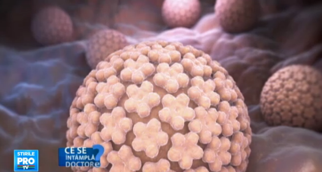Metodele de prevenire a infectiilor cu HPV, virusul care poate cauza cancerul. Cel mai frecvent tip