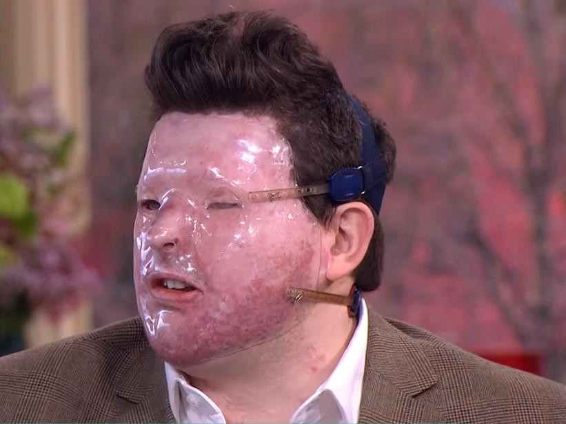 A fost luat drept altcineva, iar asta i-a distrus viata. Ce i-a spus atacatorul inainte sa-i arunce cu acid pe fata