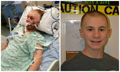 Un nou fenomen face victime printre americani. Provocarile periculoase pe care adolescentii le copiaza