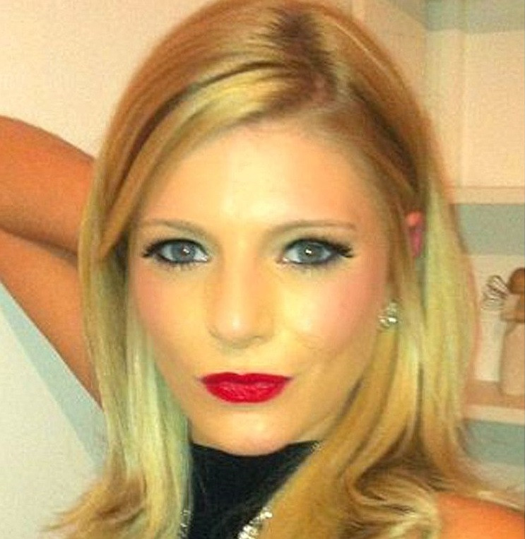 Si-a facut un tratament facial cu laser si a ramas socata cand s-a vazut in oglinda. Cum arata acum aceasta tanara