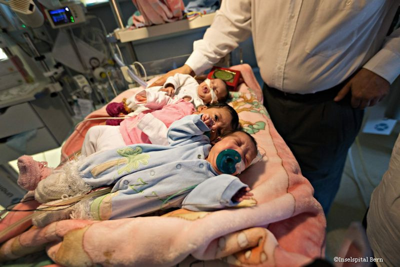 operatie siameze Elvetia