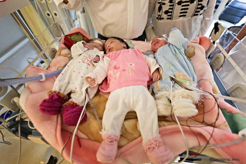 operatie siameze Elvetia