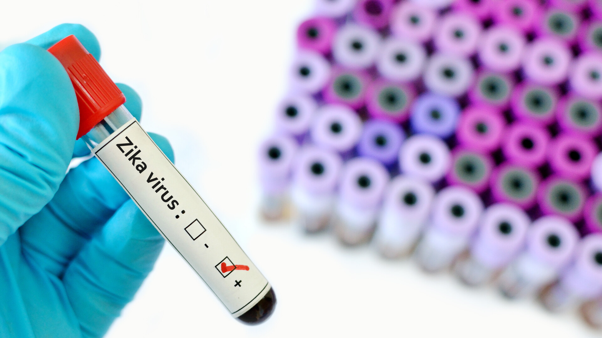 Primul caz de Zika cu care se confrunta Europa. Pacienta a revenit din Columbia si este gravida in 12 saptamani