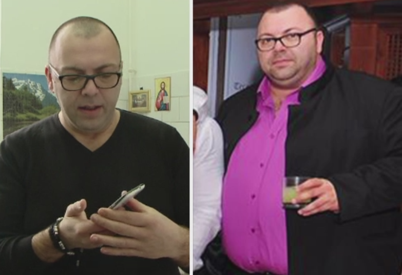 Tot mai multi tineri romani isi micsoreaza stomacul pentru a scapa de kilogramele in plus. Riscurile la care se expun