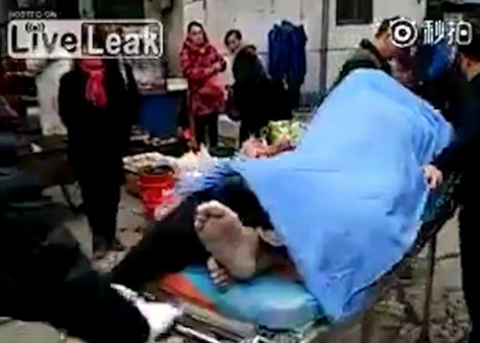 Prostituata "indepartata chirurgical" de pe clientul ei, dupa acesta a murit in timp ce faceau sex. Ce s-a intamplat