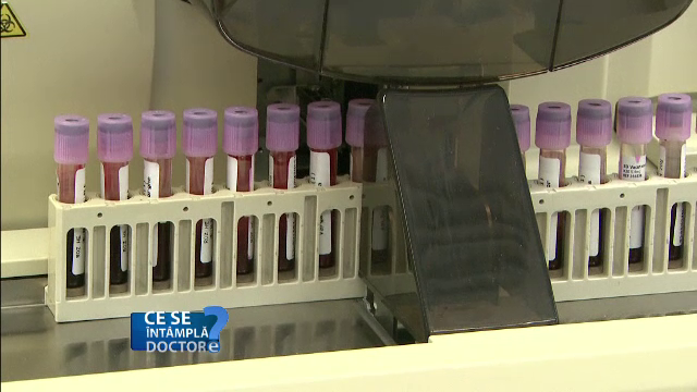 Informatiile esentiale pe care le poti afla printr-un test de urina. Valorile ridicate care tradeaza aparitia bolilor renale