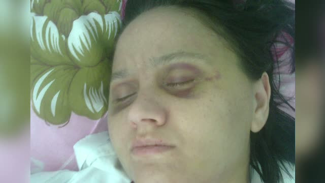 Barbatul cunoscut pe internet de o femeie din Timis a bagat-o in spital. Cum arata victima dupa "aventura amoroasa"