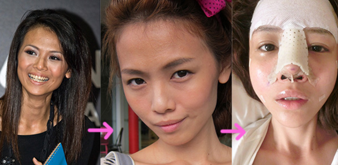 Si-a operat chipul pana cand nici ea nu s-a mai recunoscut in poze. Cum arata inainte aceasta tanara: FOTO