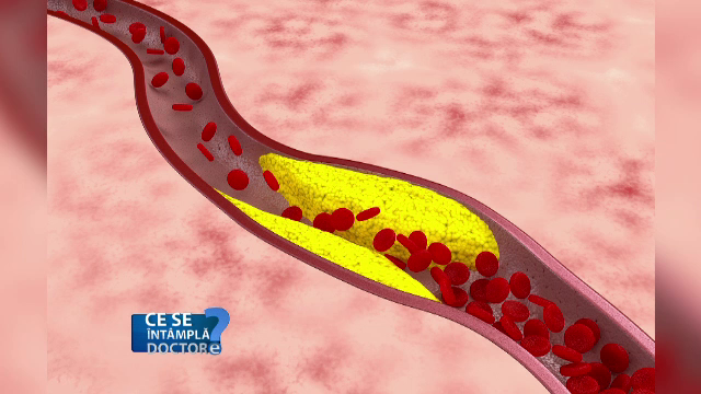 Grasimea bruna e grasime BUNA. Modul in care ne ajuta de fapt sa slabim
