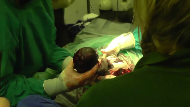 Cezariana de urgenta pentru un pui de maimuta din Anglia. Metoda folosita in premiera