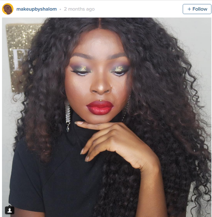 A ramas cu cicatrice pe fata dupa ce s-a ars cu ulei incins. Cum isi transforma aceasta tanara chipul intr-unul perfect