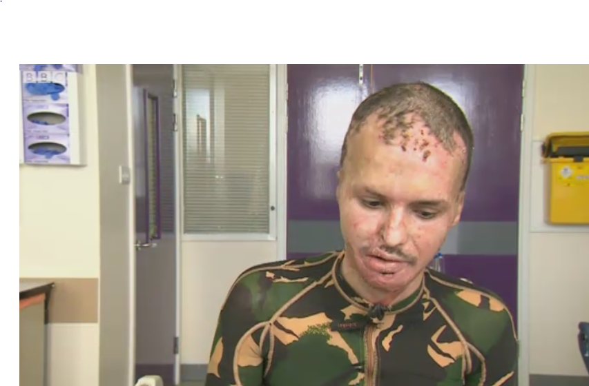 Doi supravietuitori din Colectiv au stat de vorba cu BBC despre seara tragediei. Alex si Cristian sunt tratati in Newcastle