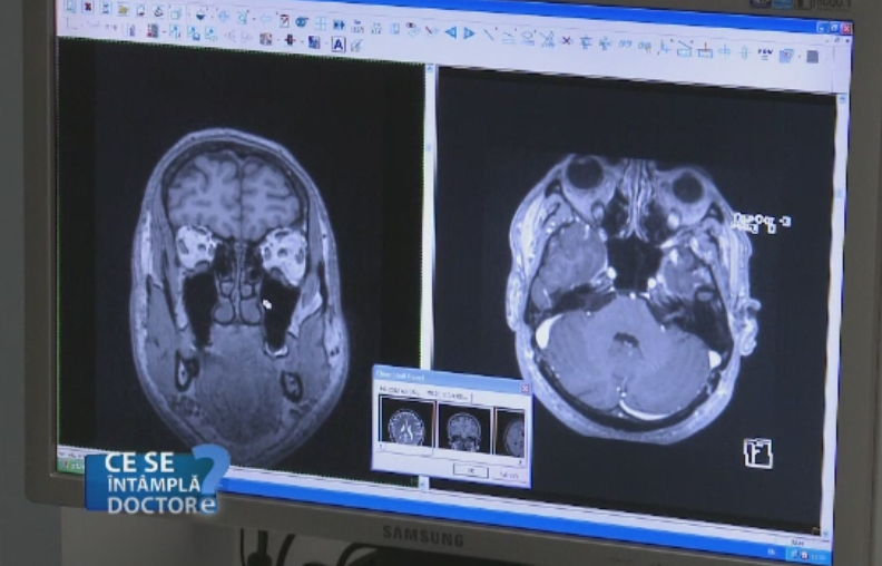 Furnicaturi, scaderea fortei musculare, scaderea simtului tactil, simptome ignorate de tineri. Ce probleme pot ascunde