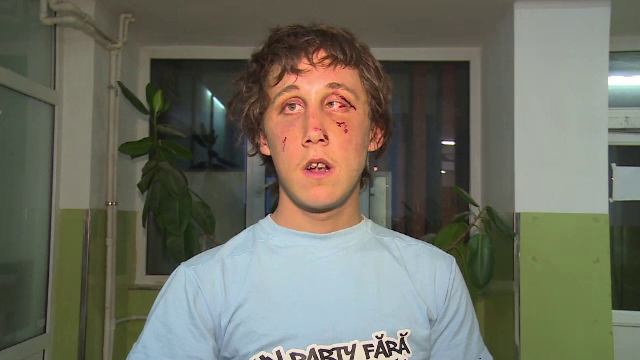 Miorita in realitate. Motivul pentru care un cioban a fost snopit in bataie de alti doi baci: "Mi-au dat cu bata-n cap"