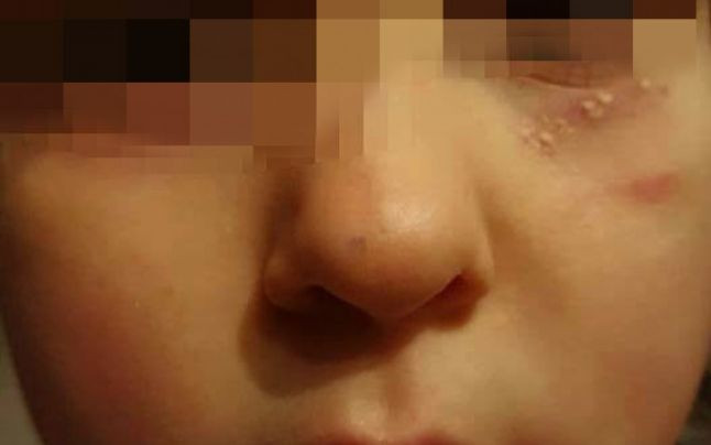 O fetita din Vaslui a venit de la gradinita cu fond de ten pe faţă. Cand a spalat-o, mama s-a speriat. Ce i-a spus fiica