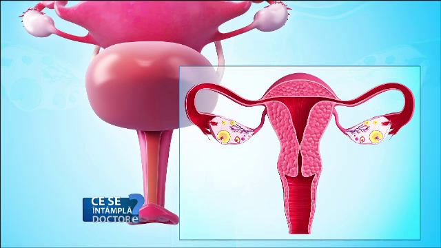 Cat de des trebuie facut testul Papanicolau. Afectiunile grave care pot fi prevenite cu aceasta investigatie