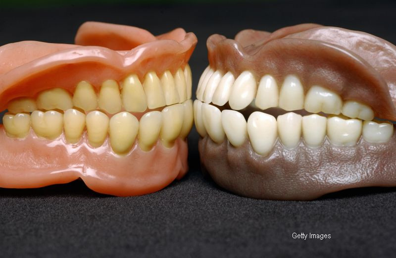 Dacii si romanii nu aveau nevoie de dentist. Care este alimentul pe care nu il consumau, iar noi il mancam zilnic