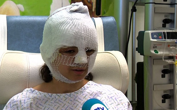 Marturia cumplita facuta de o supravietuitoare a exploziilor din Bruxelles. "A sunat ca sfarsitul lumii intr-o secunda"