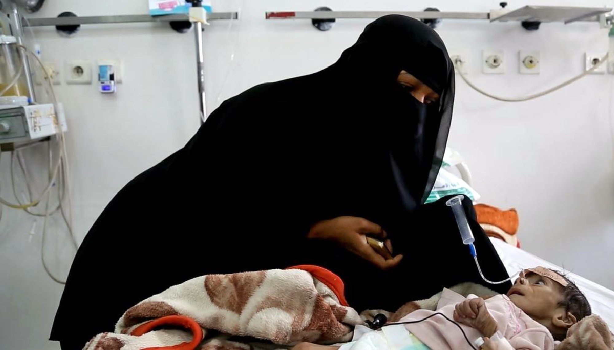 copil malnutrit Yemen - Agerpres