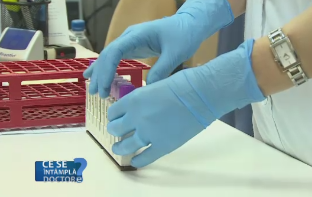 Cand devine periculos de fapt colesterolul marit din sange. Medicii explica legaturile din organism