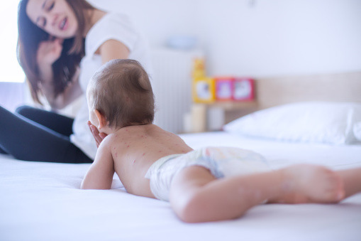 Boala rara de care sufera un copilas din Marea Britanie. Oamenii se tem sa-l atinga atunci cand il vad