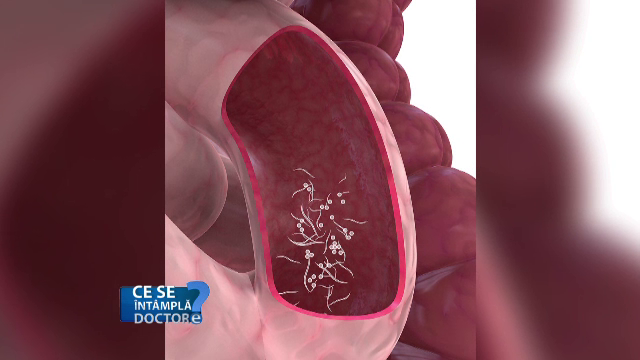 paraziti intestinali