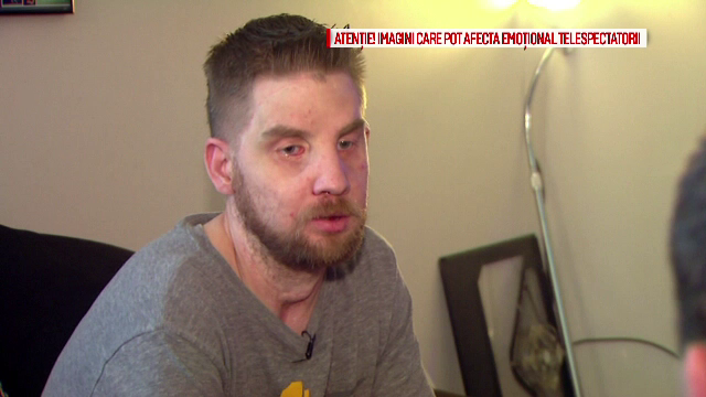 La 5 ani dupa ce a suferit un transplant de fata, un american a povestit prin ce calvar a trecut. "M-a facut mai puternic"