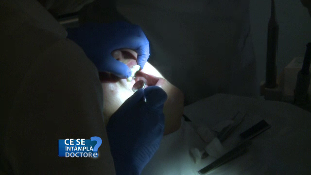 Vizitati de urgenta un stomatolog daca aveti o afta care dureaza mai mult de o saptamana. Ce afectiune grava indica