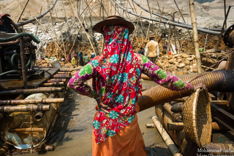 Boala rara de care sufera o femeie din Bangladesh. Ce s-a intamplat cu degetele de la mana: "Arata ca niste mingi de fotbal"