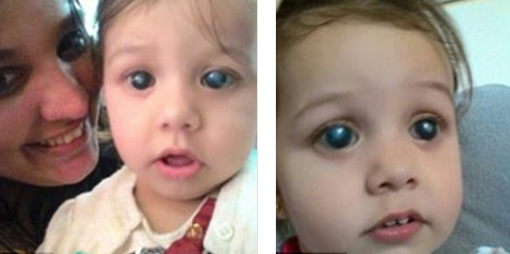 Momentul emotionant in care o fetita oarba isi vede pentru prima data mama. Medicii au numit cazul ei un adevarat miracol