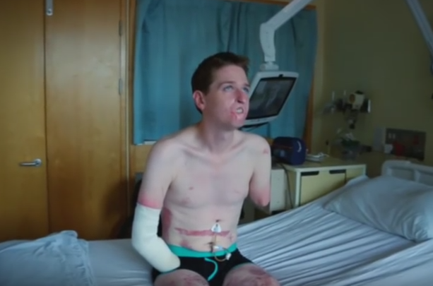 "Baietelul meu s-a uitat la mine si a fugit ingrozit". Boala care l-a desfigurat si l-a lasat fara membre pe un britanic