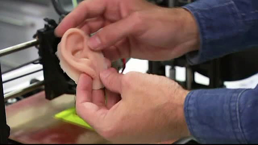 Cercetatorii australieni au scos la imprimanta o URECHE. Cat de putin ar putea ajunge sa coste un organ artificial