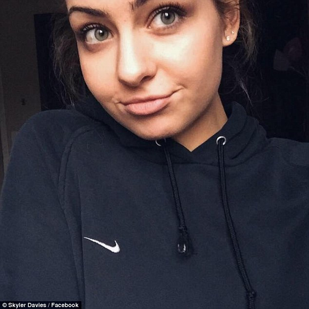 Este una dintre cele mai distribuite imagini pe internet, in ultimele zile. Ce a patit aceasta adolescenta