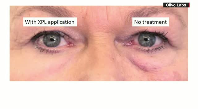 "Pielea artificiala elastica", secretul unui chip fara riduri si cearcane. Cum se obtine crema minune