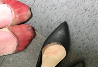Cum arata picioarele unei chelnerite dupa o zi de munca in care a fost obligata sa poarte tocuri. Imaginea a ajuns viral