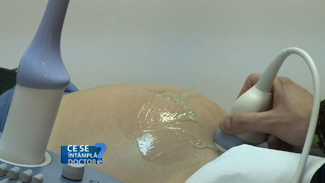 Metoda prin care cuplurile pot afla de eventualele anomalii ale fatului. Analiza materialului genetic feminin