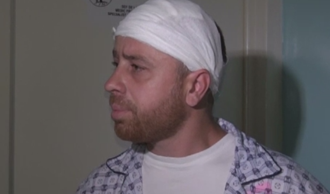 S-a ales cu o fractura craniana dupa ce a fost lovit din senin cu o bata in cap. Ce facea galateanul in acel moment