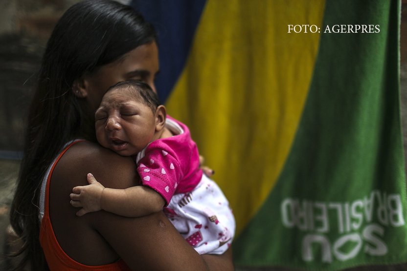 copil cu microcefalie provocata de virusul Zika, in Brazilia