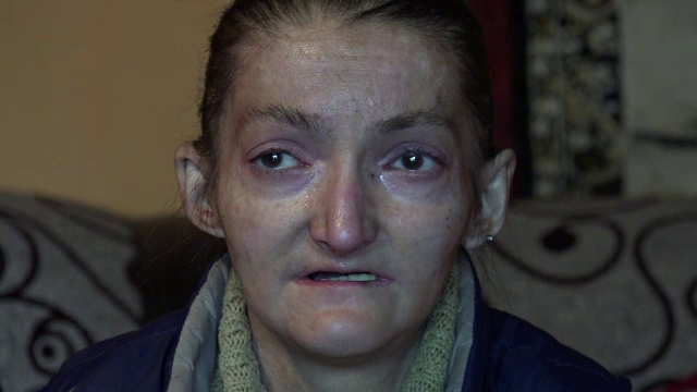 Chinul cumplit al unei femei din Alba, care sufera de o boala rara. Are nevoie de un tratament scump pentru a scapa de dureri