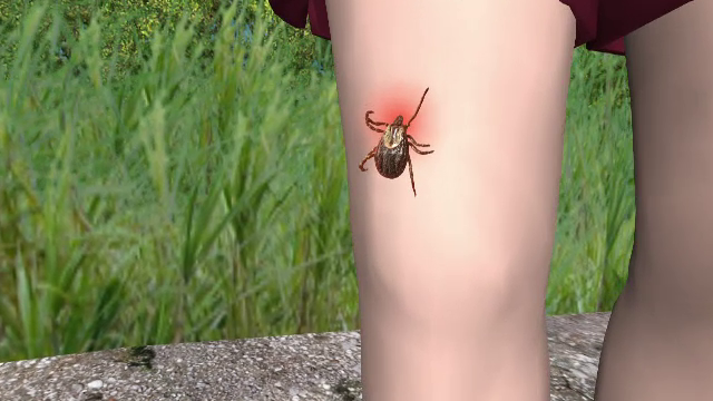 Zeci de bucuresteni au ajuns la spital, muscati de capuse. Medicii spun cum ne putem apara de atacul insectelor