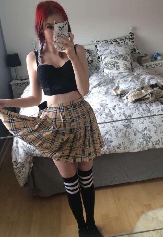 Chinurile prin catre trece aceasta adolescenta. Boala care a obligat-o sa isi scoata muschii coapselor: cum arata. FOTO