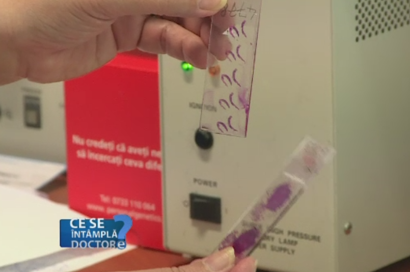 Pana si medicii se tem de tumorile ovariene. Analizele recomandate de specialisti pentru controlul anual obisnuit