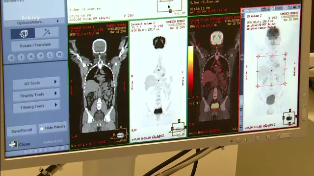 Sef de laborator de la Spitalul de Neurochirurgie din Iasi, retinut de DNA. Medicul refuza cazurile venite in urgenta