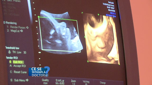 Afectiunea de care sufera 10% dintre gravide. Ce tip de medicatie se recomanda in cazul acestei boli