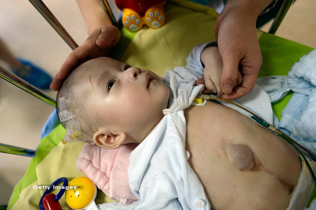 Bebelus abandonat pe strada de mama pentru ca s-a nascut cu inima in afara corpului. Ce spun medicii despre starea lui
