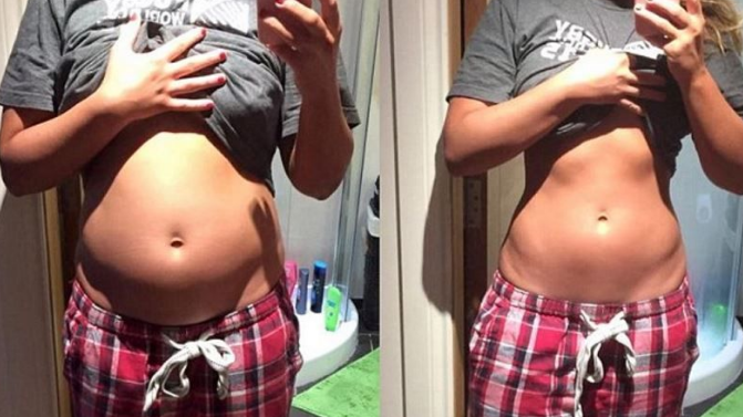 Si-a fotografiat abdomenul si multi au crezut ca e insarcinata. Surpriza uriasa cand au vazut cum arata insa a doua zi: FOTO