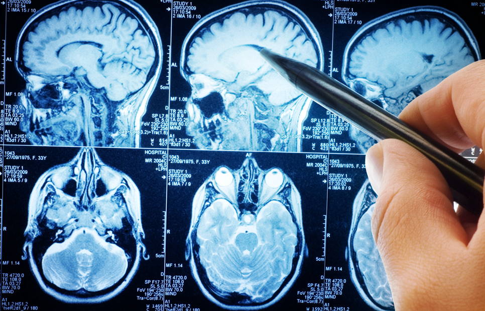 A plecat intr-o excursie organizata de biserica si a murit. Ce au descoperit medicii in creierul adolescentei