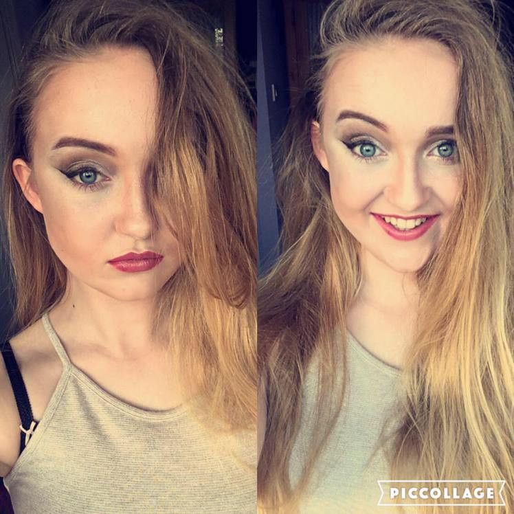 "Va rog, ajutati-ma! Nu mai suport sa arat asa!" Strigatul de ajutor al unei fete care sufera de o boala bizara